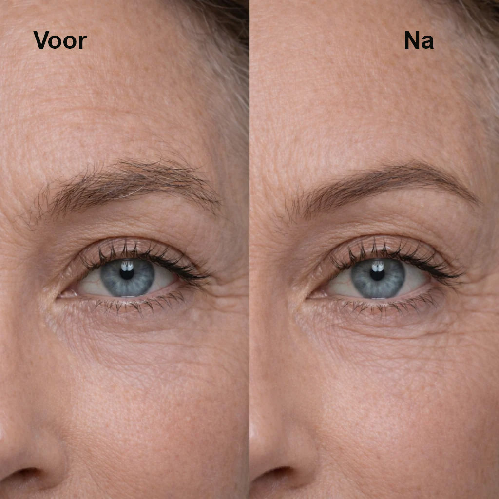 SafeTrim™ – Elektrische haartrimmer voor intieme zones