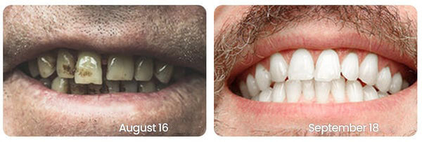 Eptchn™ Whitening Tandpasta voor Stralend Witte Tanden
