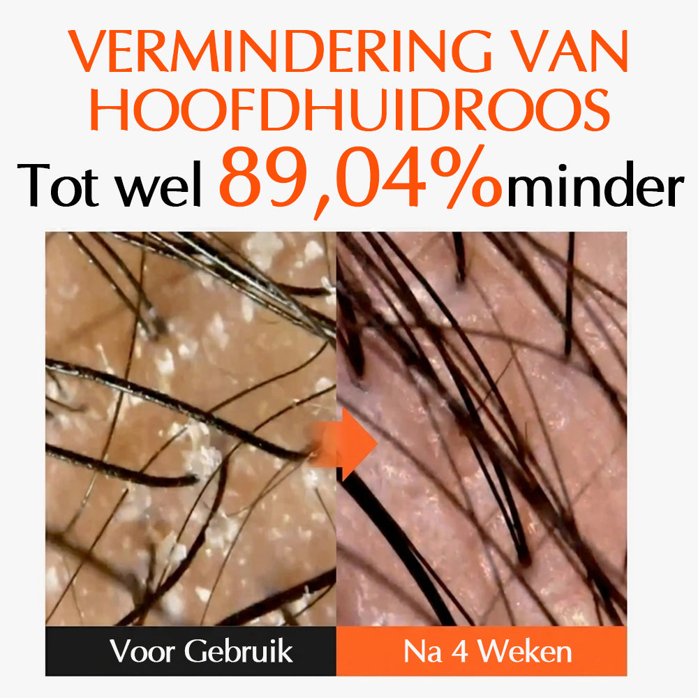 Luméa™ Haargroei Serum
