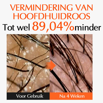 Luméa™ Haargroei Serum