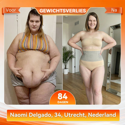 ShapeFit Afval Shorts • Zichtbaar resultaat (o)