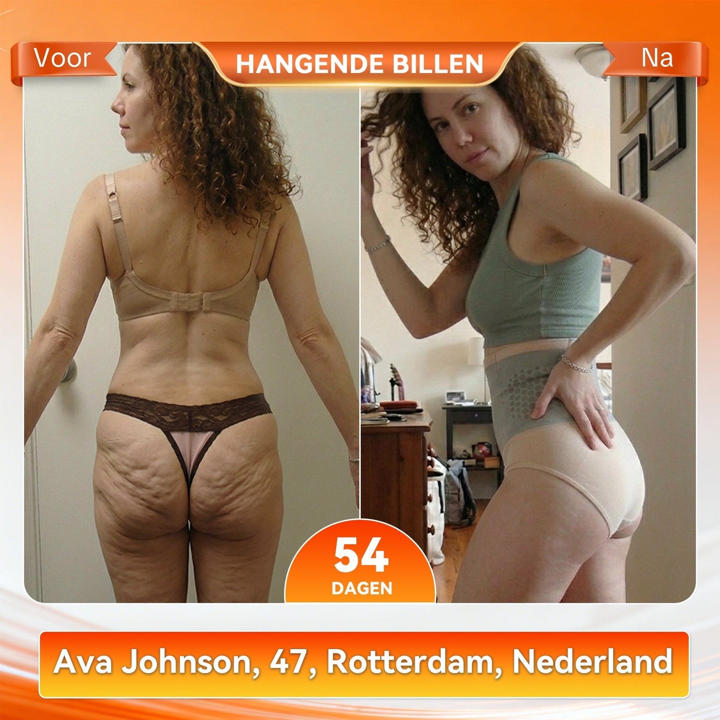 ShapeFit Afval Shorts • Zichtbaar resultaat (o)