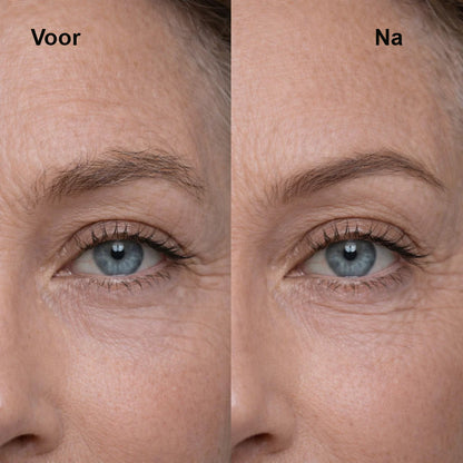 SafeTrim™ – Elektrische haartrimmer voor intieme zones