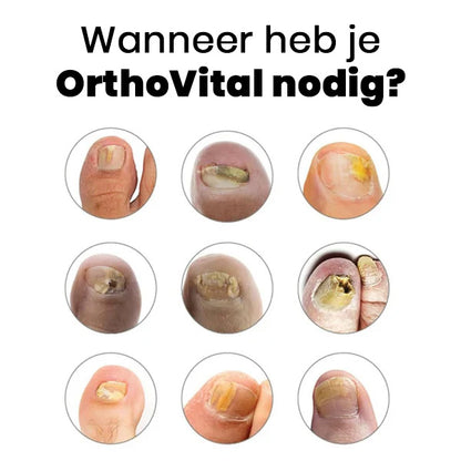 "OrthoVital" Doodt nagelschimmel in 7 minuten.