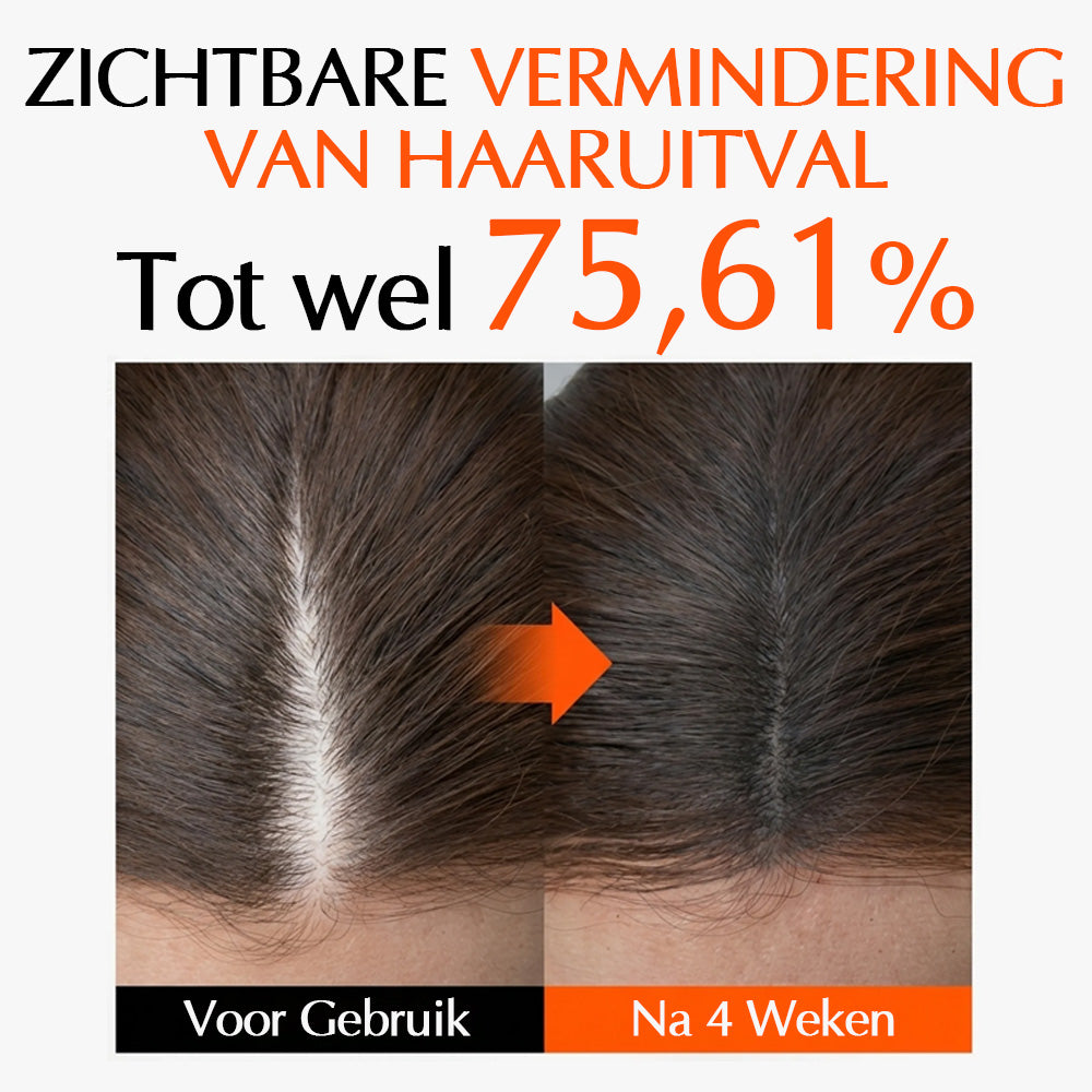 Luméa™ Haargroei Serum
