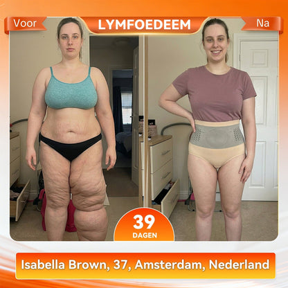 ShapeFit Afval Shorts • Zichtbaar resultaat (o)