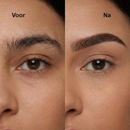 SafeTrim™ – Elektrische haartrimmer voor intieme zones