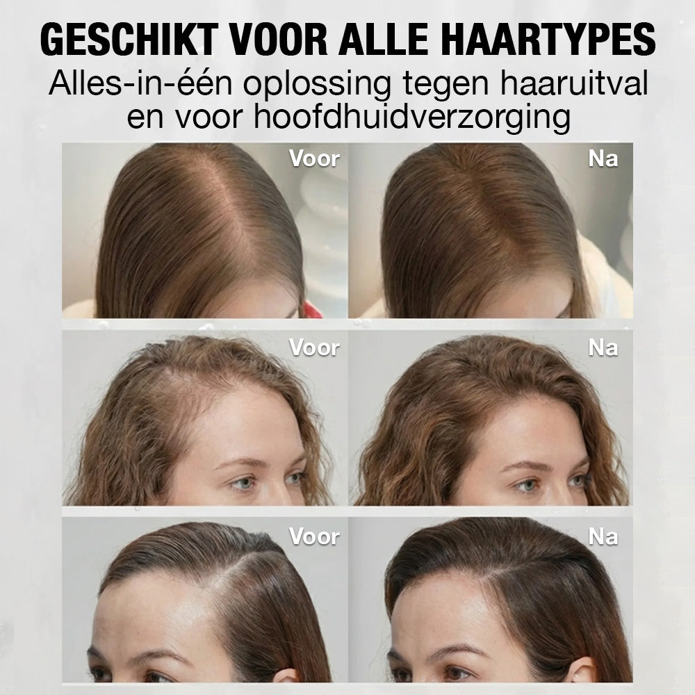 Luméa™ Haargroei Serum