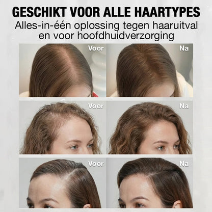 Luméa™ Haargroei Serum