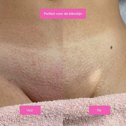 SlimSkin Cyperus Oil | Zijdezachte huid, zonder scheren