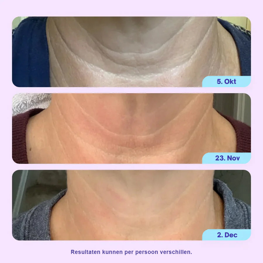Lift & Sculpt Halscrème – Voor een Strakkere Hals en Kaaklijn