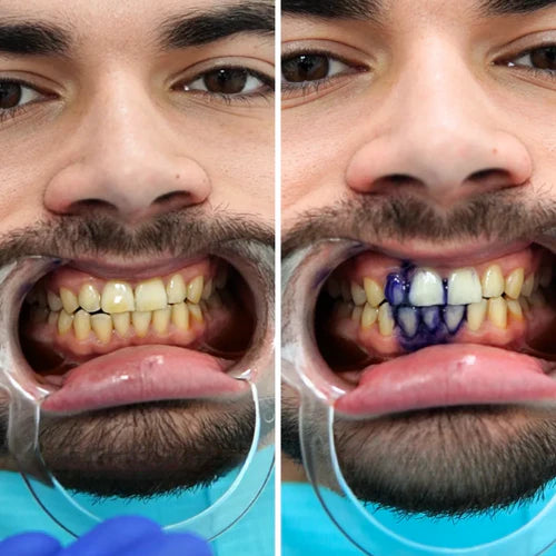 Smilepop Whitening Serum