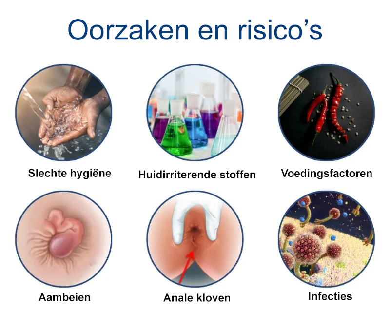 Miréa Relief Spray ™ – Snelwerkende Spray tegen Aambeien