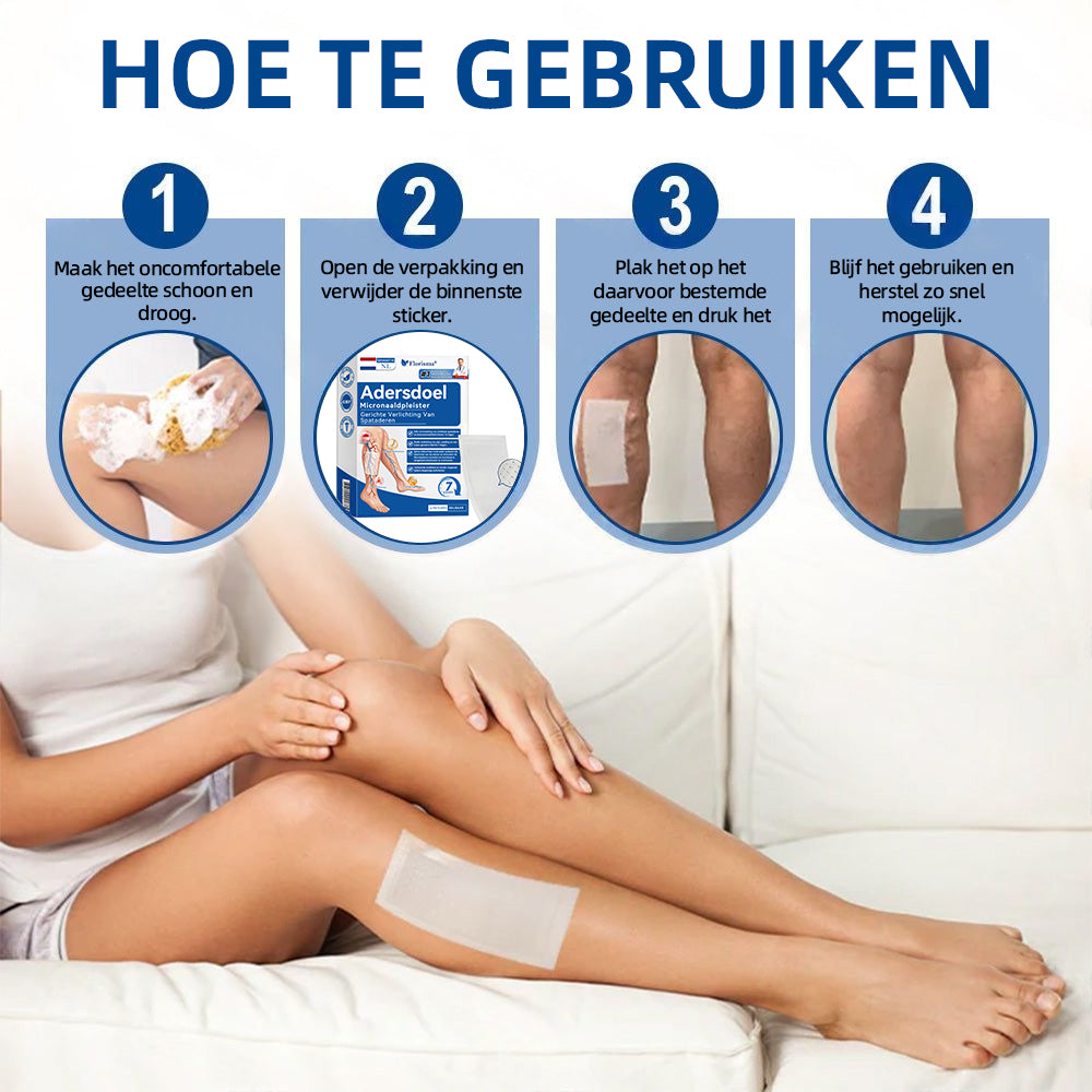 Florisma® – Zichtbaar minder spataderen in enkele weken