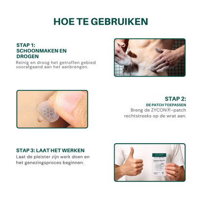 Hofstede ® Magnesium MicroPin HPV Genitale Wrat Verwijdering Patch