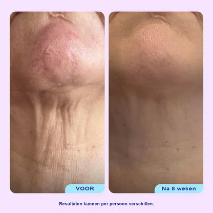 Lift & Sculpt Halscrème – Voor een Strakkere Hals en Kaaklijn