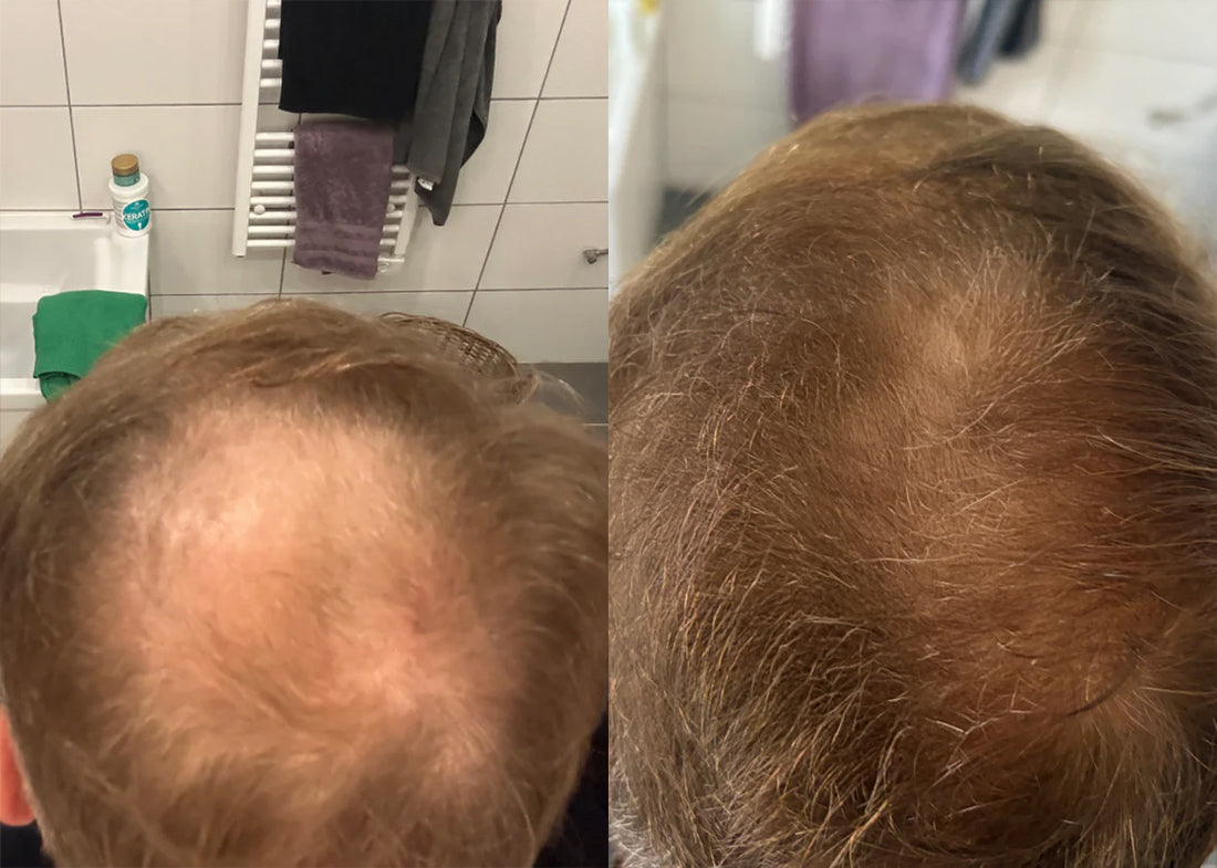 Follicare Hair Revive Serum