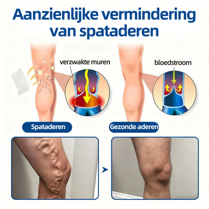 Florisma® – Zichtbaar minder spataderen in enkele weken