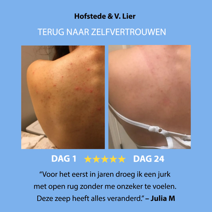 Anti-Acne  Soap