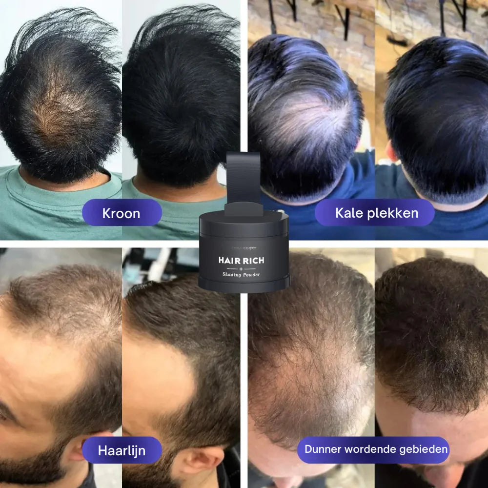 Aura™ Haar Dichtheidsvuller