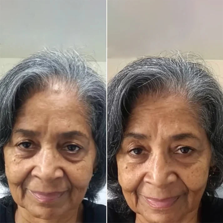 Miréa™ Haargroeispray voor Sterk en Gezond Haar