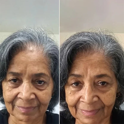 Miréa™ Haargroeispray voor Sterk en Gezond Haar