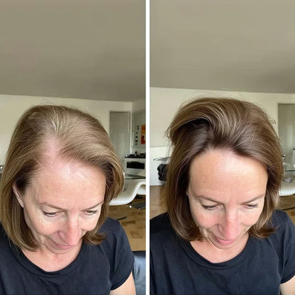 Miréa™ Haargroeispray voor Sterk en Gezond Haar