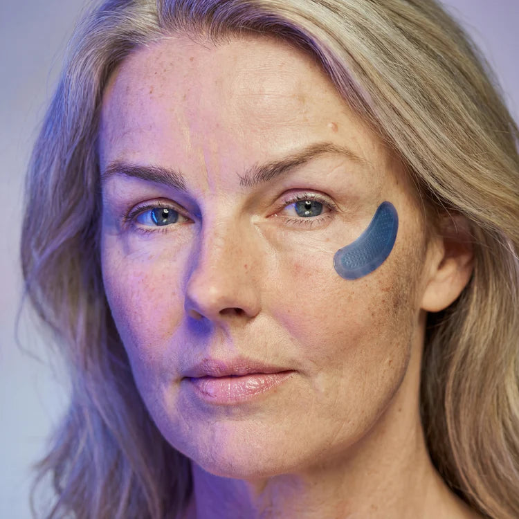 Micro-Infusion Patches