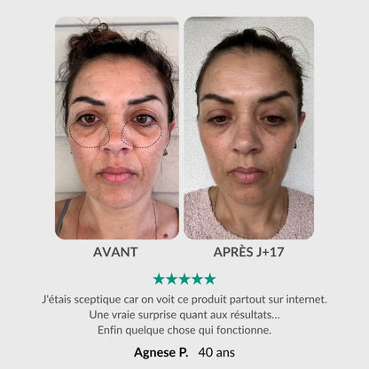 Nuvaskin™ - Pen & Activerend Serum