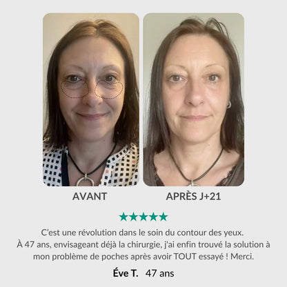 Nuvaskin™ - Pen & Activerend Serum