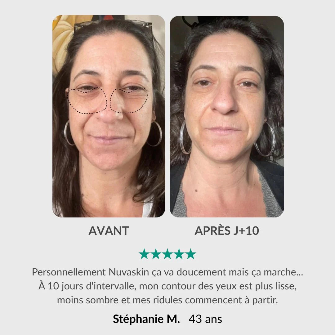 Nuvaskin™ - Pen & Activerend Serum