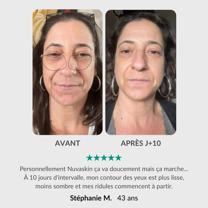 Nuvaskin™ - Pen & Activerend Serum