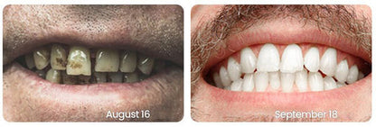 Eptchn™ Whitening Tandpasta voor Stralend Witte Tanden