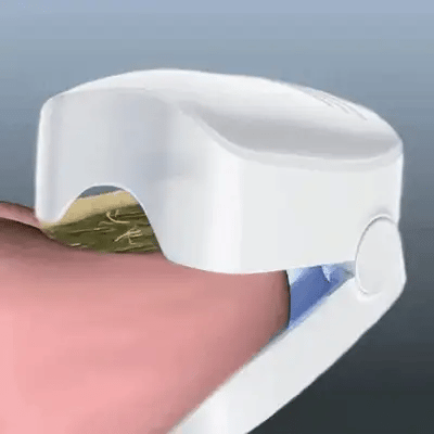 "OrthoVital" Doodt nagelschimmel in 7 minuten.