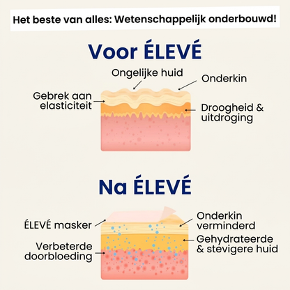 ÉLEVÉ | V-Line Lifting Mask