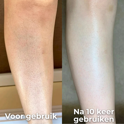 Strawberry™ Huidvernieuwende Crème