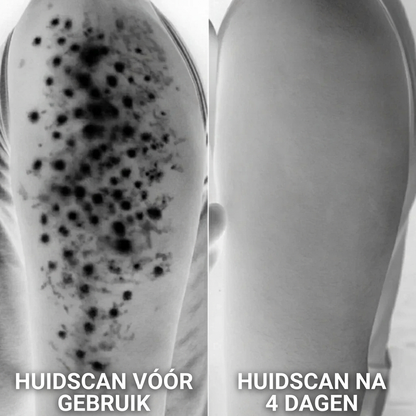 Strawberry™ Huidvernieuwende Crème