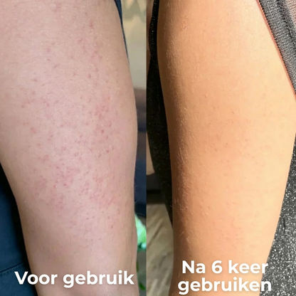 Strawberry™ Huidvernieuwende Crème