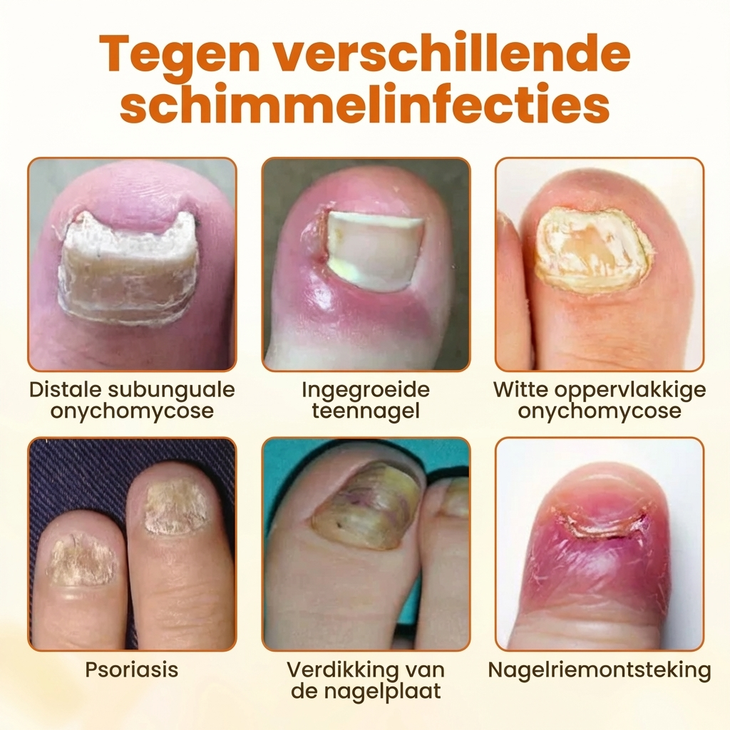 FungiBee Nagelherstel Spray