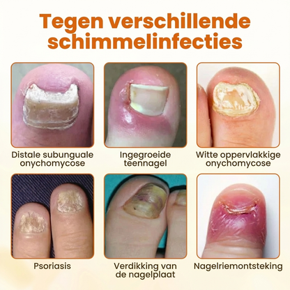 FungiBee Nagelherstel Spray