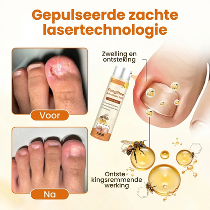 FungiBee Nagelherstel Spray