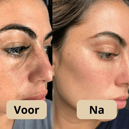 Lumeva™  | Korean Peel Shot – Verbetert je huid