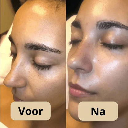 Lumeva™  | Korean Peel Shot – Verbetert je huid