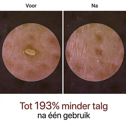 Lumeva™  | Korean Peel Shot – Verbetert je huid