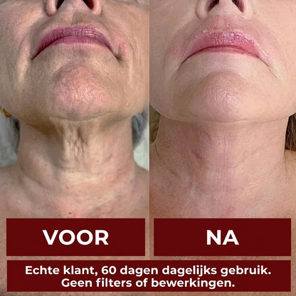 RejuvaNAD +