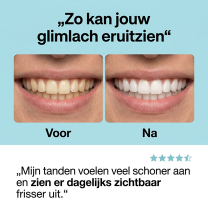 Shinly® – 30 Seconden Tandenborstel
