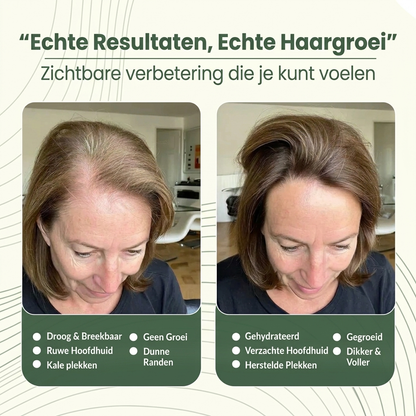 Lumin | Batana Haargroei Olie  • Zichtbaar resultaat