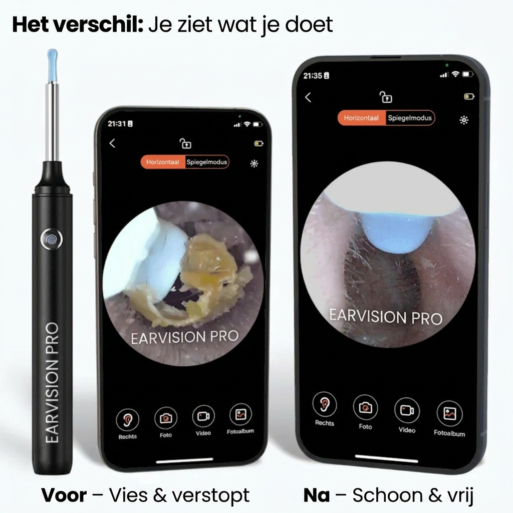 EarVision Pro™ | HD Oorcamera met Veilige Reiniging