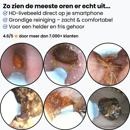 EarVision Pro™ | HD Oorcamera met Veilige Reiniging