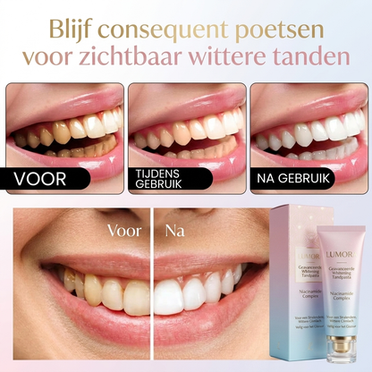Lumora™ | Whitening Tandpasta voor Stralend Witte Tanden